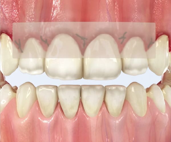 ora-aid-periodoncia-lhumat